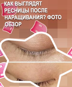 Как быстро восстановить ресницы после наращивания форум