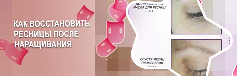 Как восстановить ресниц после наращивания